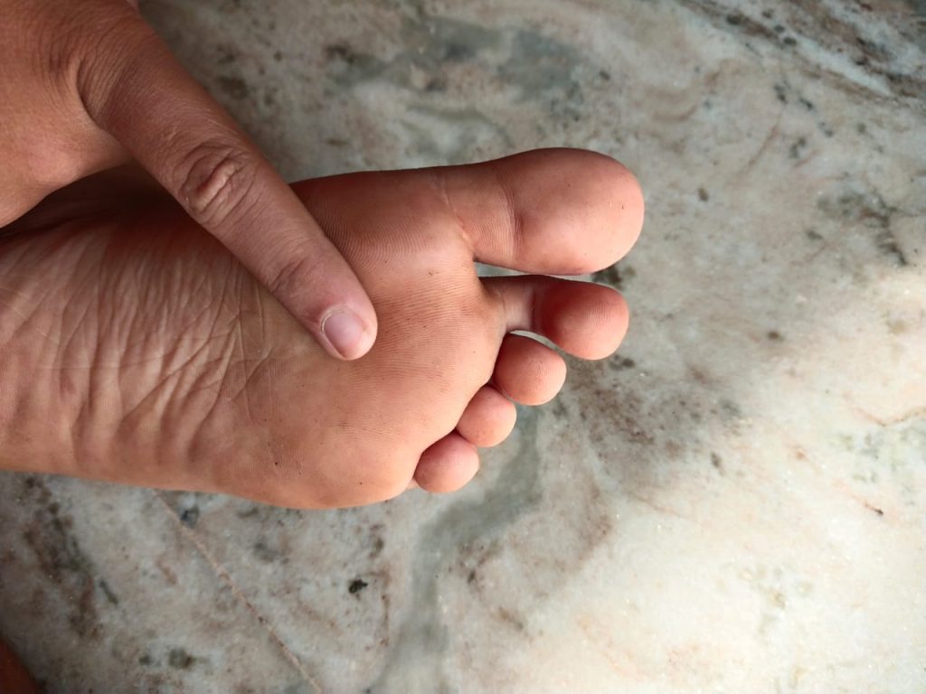 acupuncture points in yin yoga ttc 2