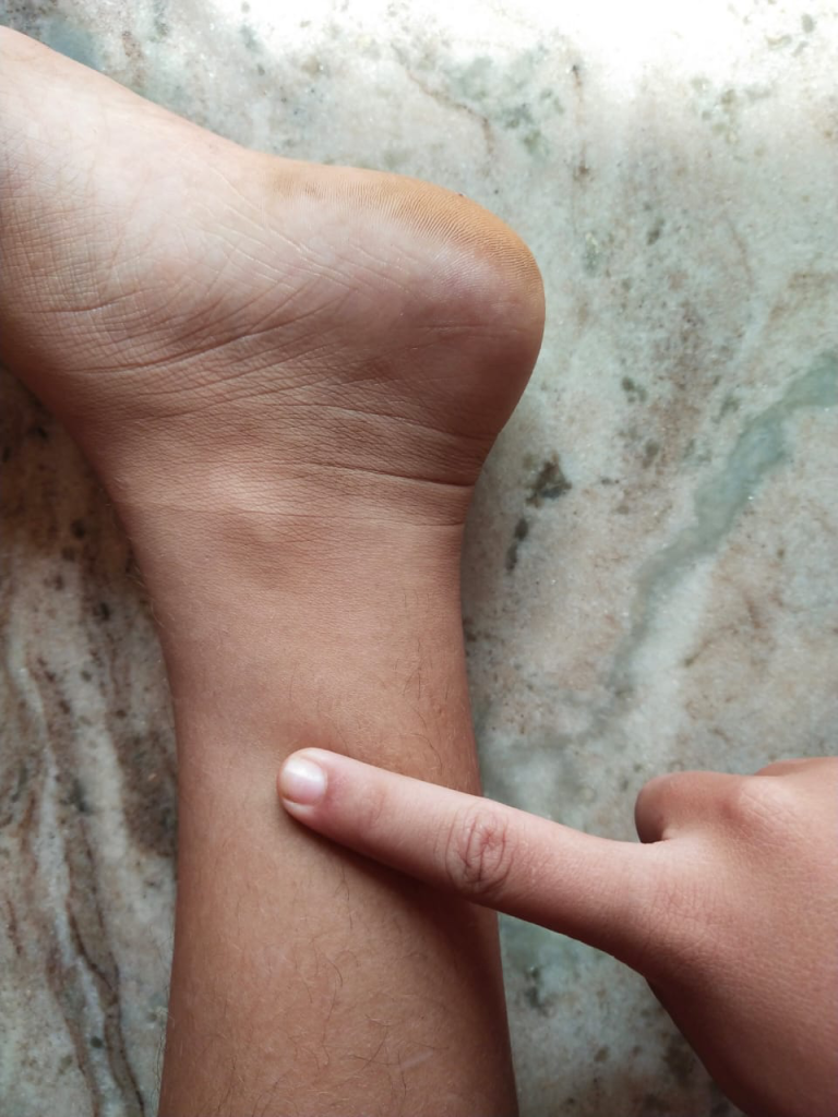 acupuncture points in yin yoga ttc 3